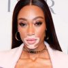 Winnie Harlow Measurements Height Weight Bra Size Body Stats Facts
